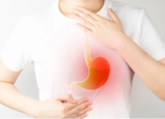 Tidur Habis Sahur Dapat Menyebabkan Asam Lambung Naik