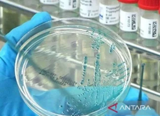 Australia Catat Kasus Pertama Flu Burung pada Mamalia